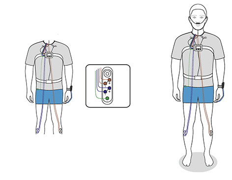 Nox T3 set-up step — attaching optional leg leads for restless legs and periodic limb movement